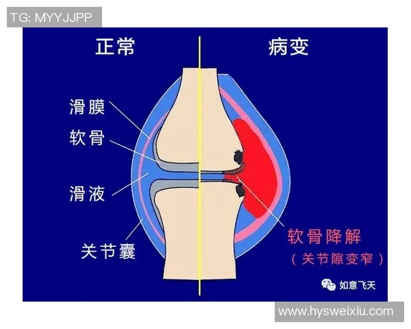 探讨足球明星的胯骨宽度对运动表现的影响与科学解析